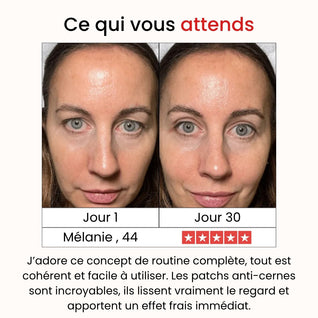 Coffret Régénération Intense