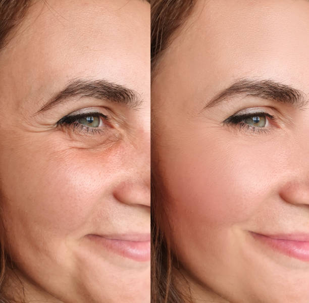 1. Parce que votre peau ne mérite pas d’attendre